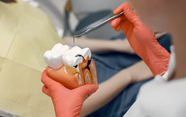 Root Canal Treatment
